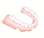 総入れ歯が安定しない場合